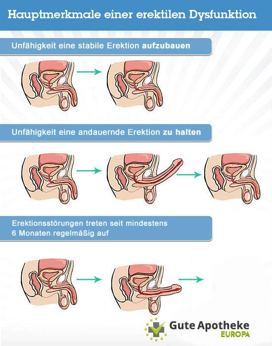 Erektile Dysfunktion Symptome
