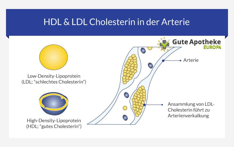Hoher Cholesterinspiegel 