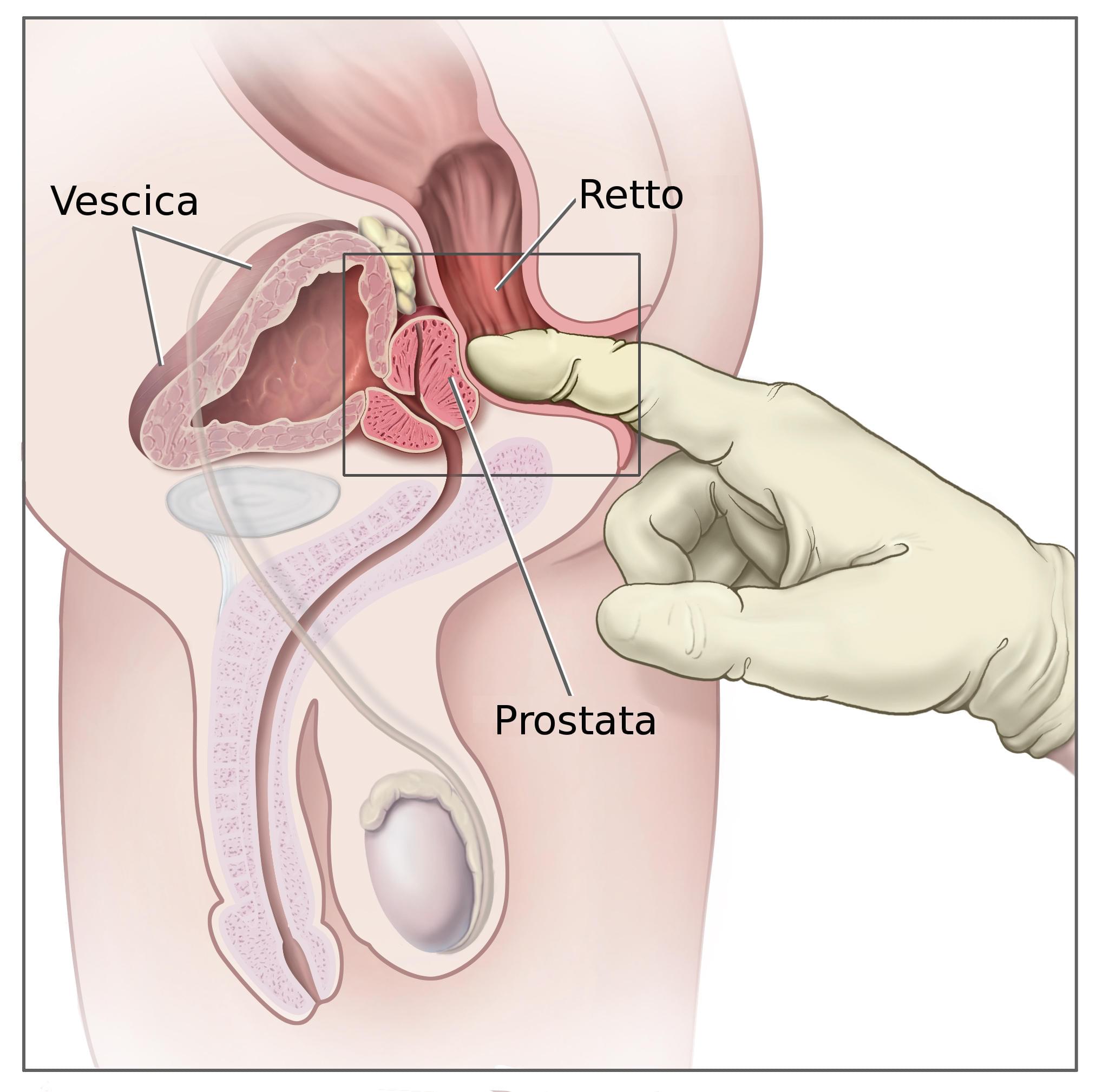 prostata